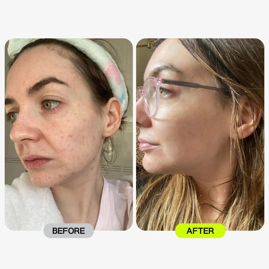 Glotech™ Pro Mask + Collar